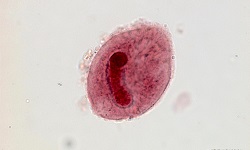 Balantidium coli